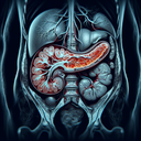 МРТ підшлункової залози